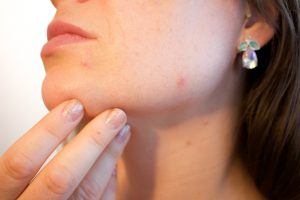 איך לשמור על עור הפנים - חלק ונקי מפצעונים